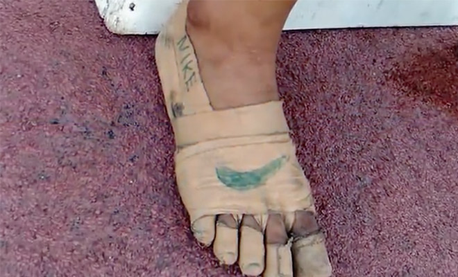 Сверстники смеялись над бедной спортсменкой. Но она пришла на соревнования в самодельной обуви и выиграла 3 медали - свежие новости на Toplenta