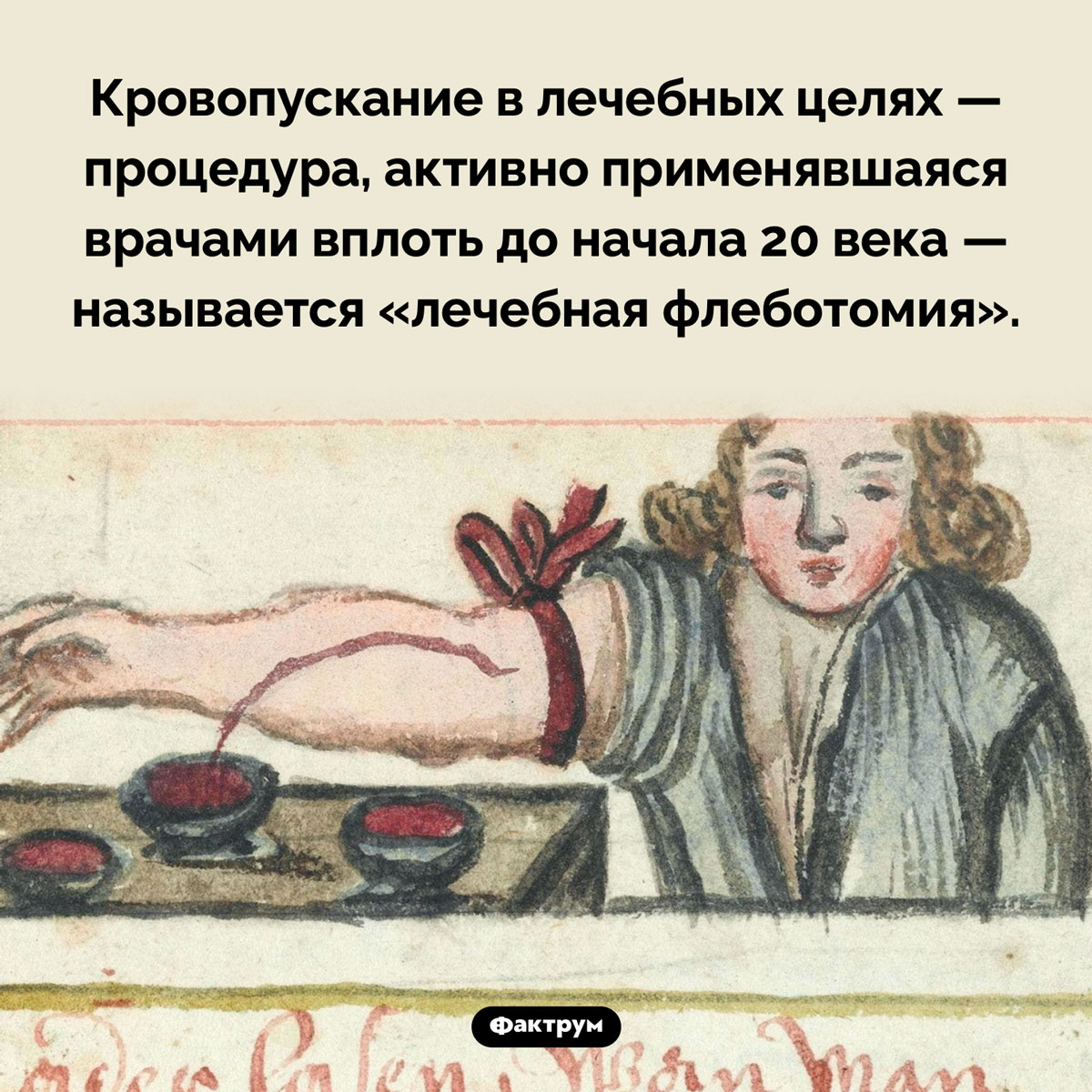 Как называется процедура кровопускания - свежие новости на Toplenta по теме названия