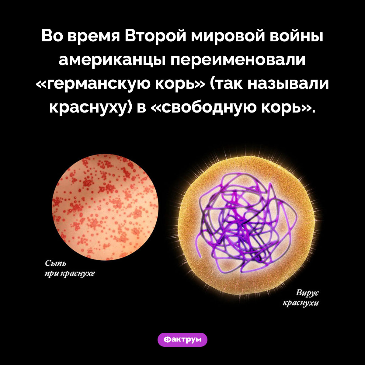 Как германская корь стала свободной - свежие новости на Toplenta по теме германия
