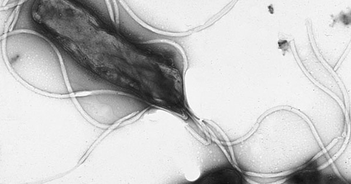 От чего возникает язва желудка - похожая новость на Toplenta