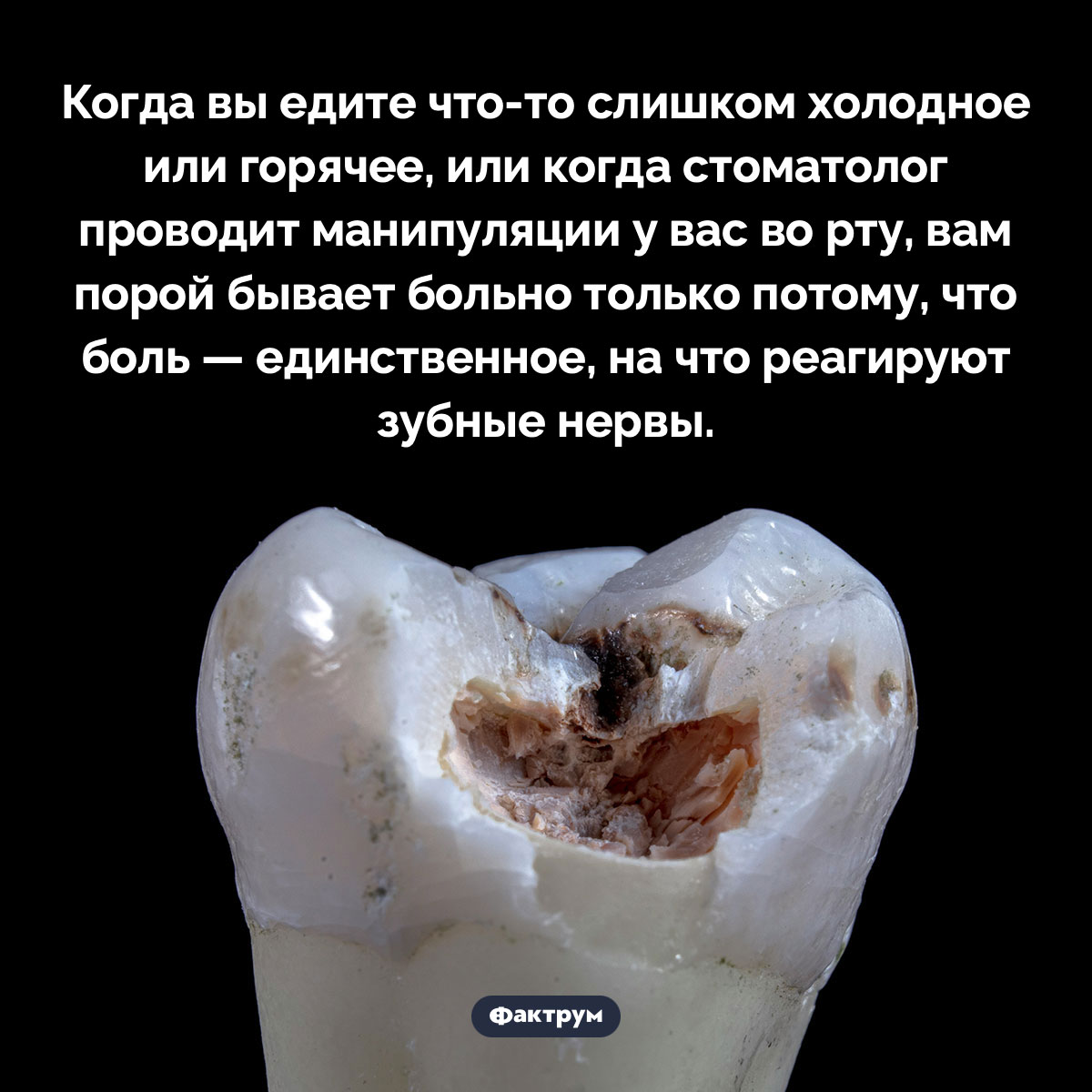 Зубы могут чувствовать только боль - свежие новости на Toplenta по теме Факты в картинках