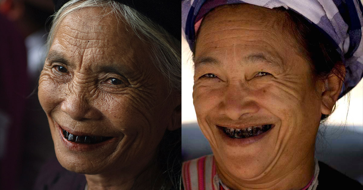 Почему в старину чернили зубы: эстетика и статус - свежие новости на Toplenta по теме Зубы