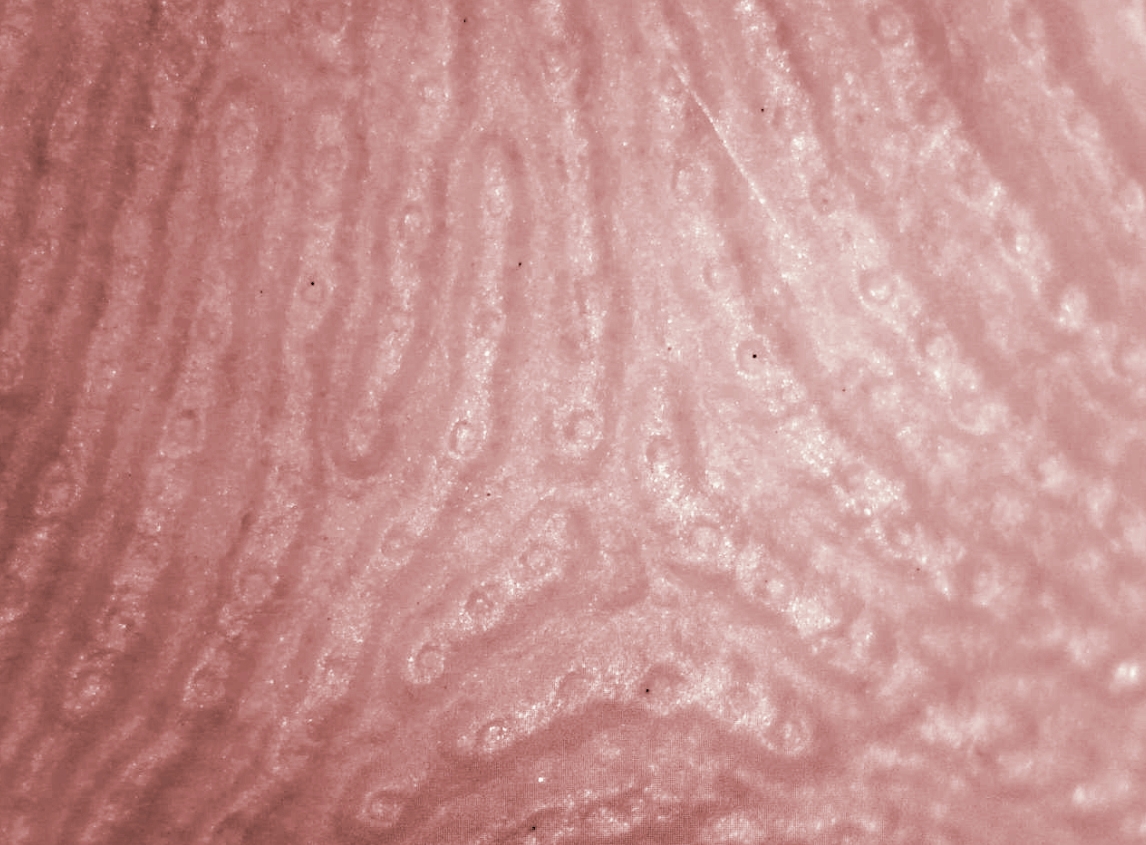 Почему пот воняет именно в подмышках? - похожая новость на Toplenta