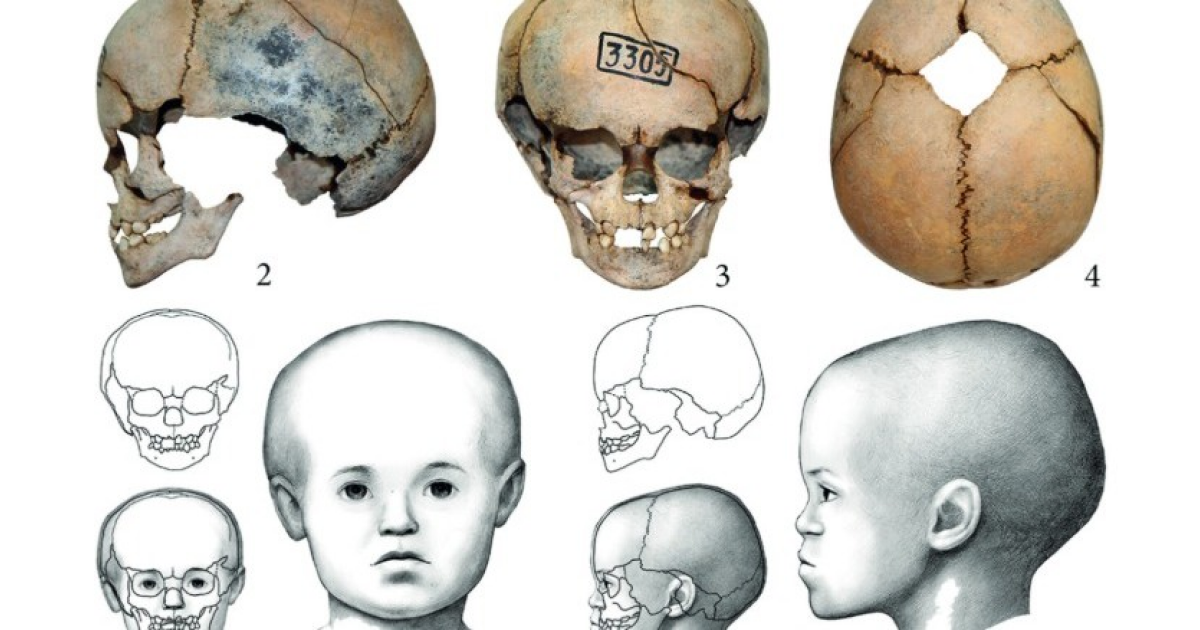 Захоронение древнего малыша с макроцефалией назвали вертикальным или вторичным - похожая новость на Toplenta