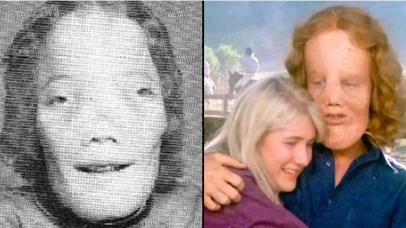 Рой Ли Деннис: как история подростка с редкой болезнью стала сюжетом фильма - свежие новости на Toplenta по теме Маск