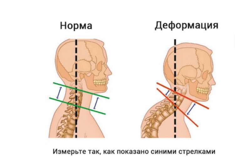 Почему со временем меняется овал лица - свежие новости на Toplenta по теме Краснуху