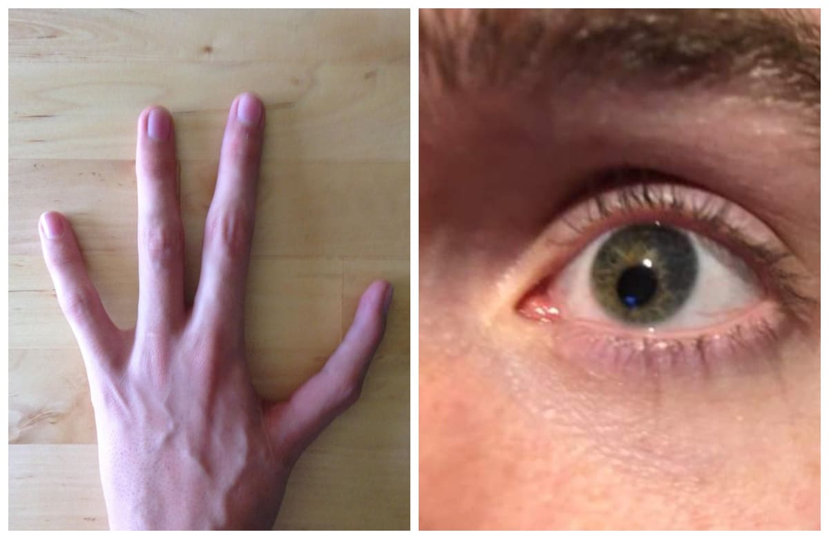 Не такие как все: 22 фото людей, которых природа сделала не похожими на других - свежие новости на Toplenta по теме Здоров