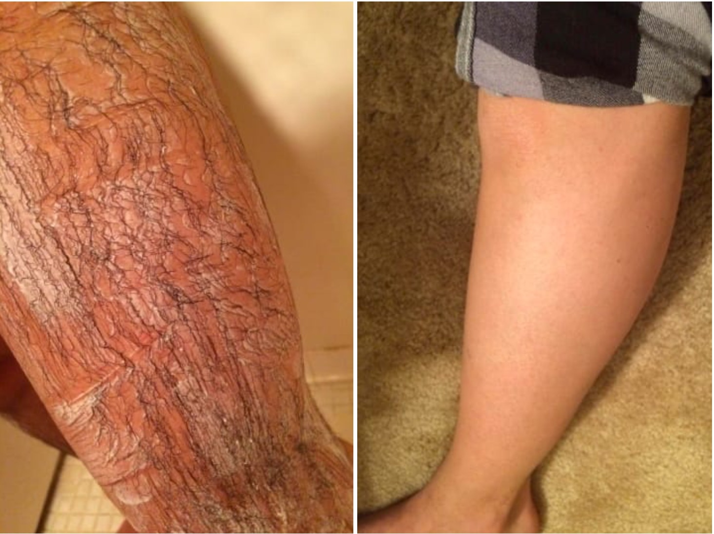 Без фотошопа: 26 товаров, которые подтвердили свою эффективность - свежие новости на Toplenta по теме Эффективно