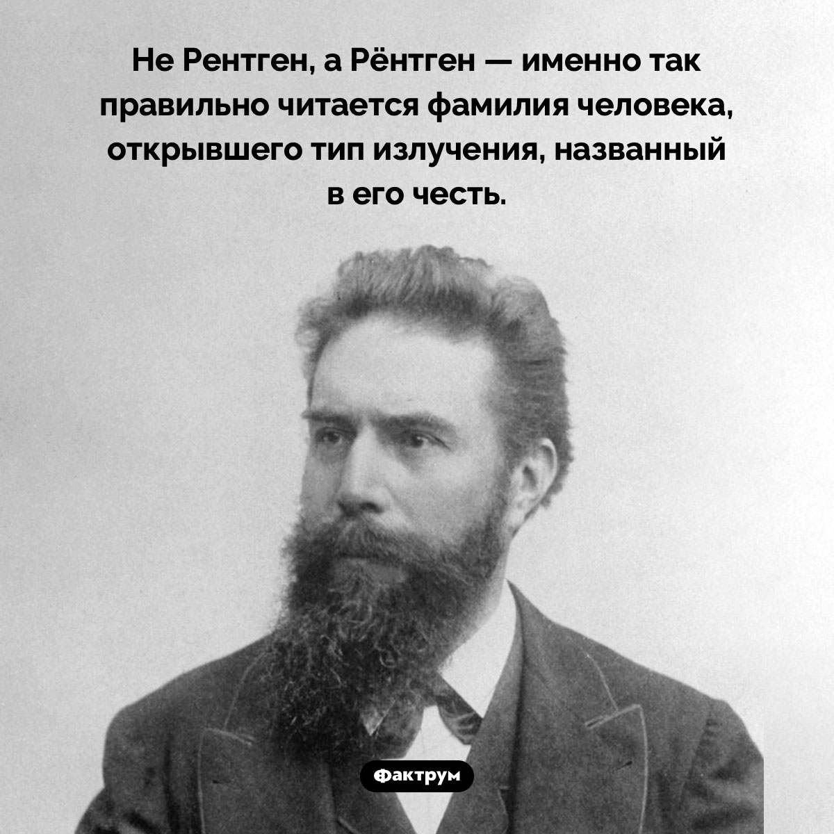 Рёнтгеновское излучение - свежие новости на Toplenta