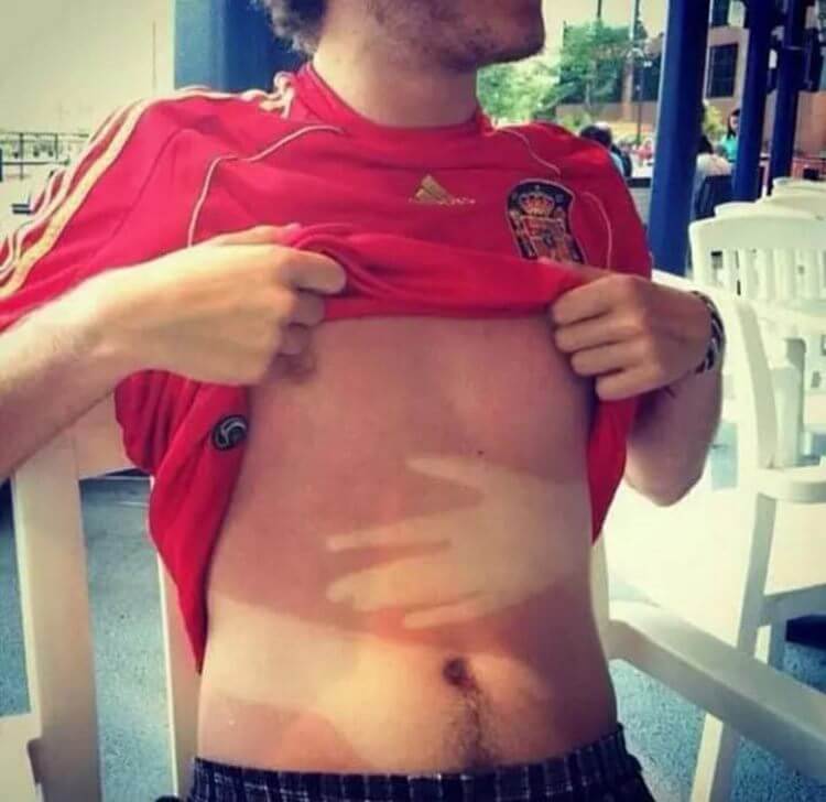 18 фото, которые заставят вас пользоваться солнцезащитным кремом - свежие новости на Toplenta