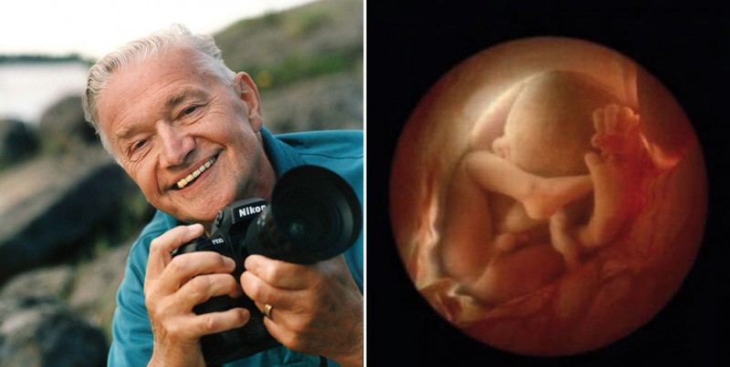 Уникальные кадры — от зачатия до рождения - свежие новости на Toplenta по теме Наук