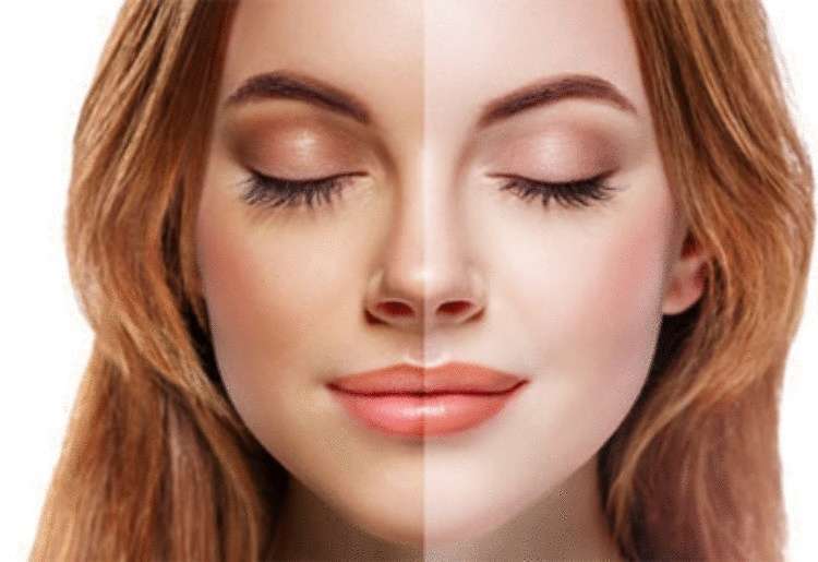 Советы дерматологов для здоровой и красивой кожи - свежие новости на Toplenta по теме Краснуху