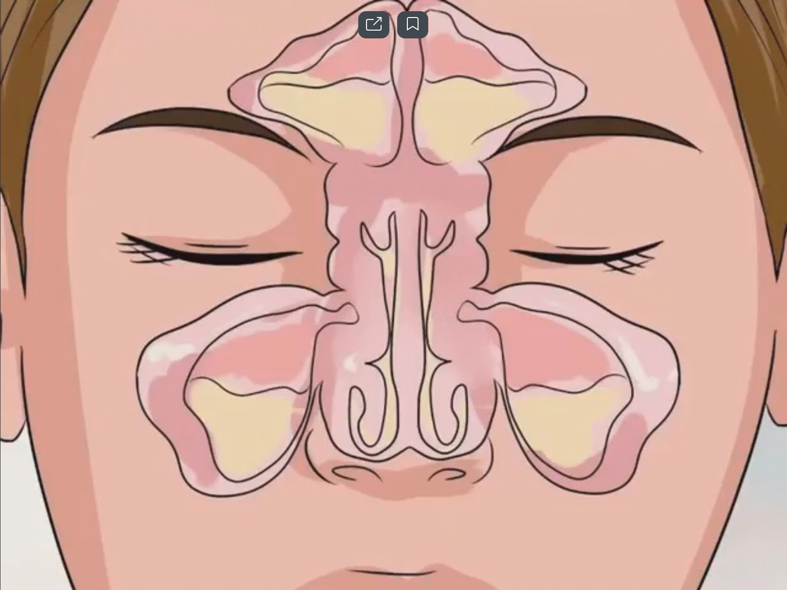 Как вывести слизь из организма - свежие новости на Toplenta по теме здоровье и медицина