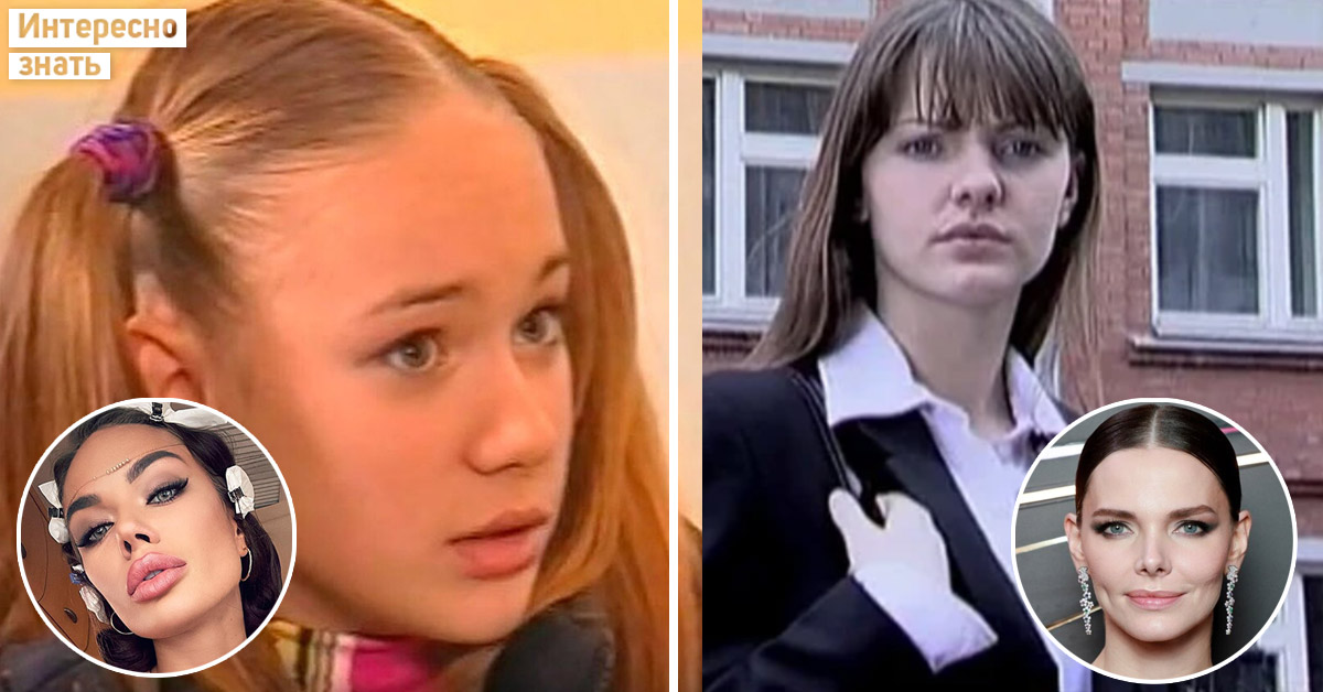 Разница налицо. Фото звездных красавиц, которые не признаются в пластике - свежие новости на Toplenta
