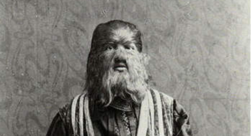 Как русский «мальчик-собака» Федя Евтихиев стал звездой цирка в США - свежие новости на Toplenta по теме гастроли