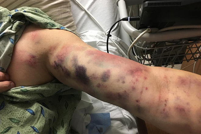 Парень не обратил внимание на укус. На следующий день он кричал от этого… - свежие новости на Toplenta по теме РАН