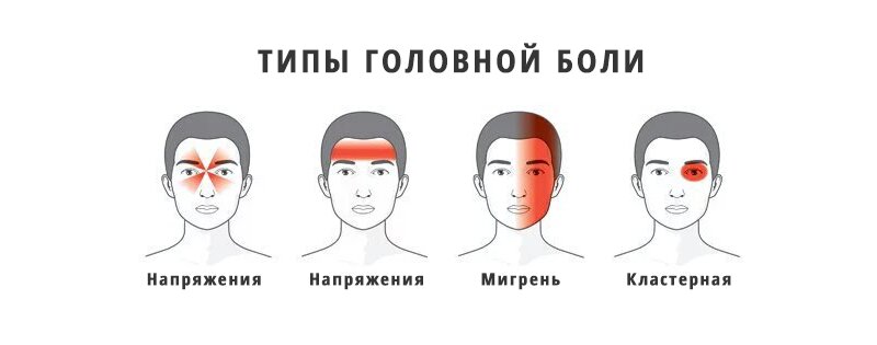 Как отличить опасную головную боль от обычной - свежие новости на Toplenta по теме ло