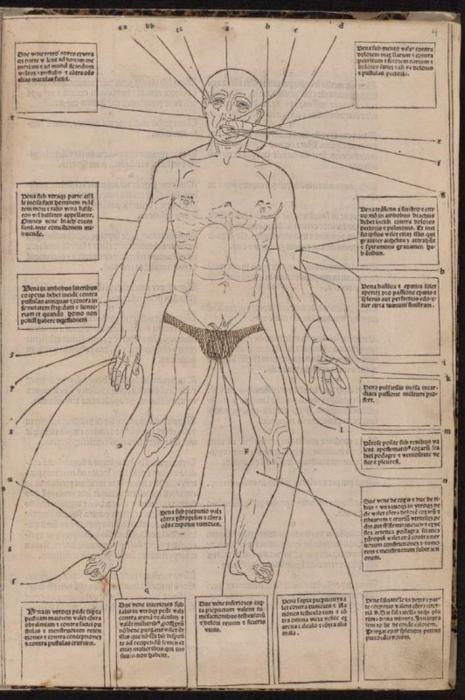 От кровопускания до распития мочи: суровая и беспощадная медицина прошлого - свежие новости на Toplenta
