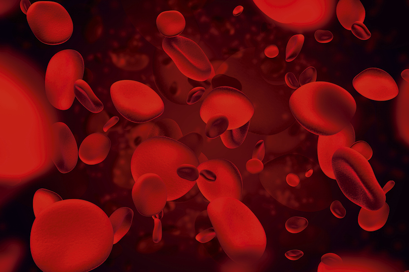 Как понять, что по телу гуляет тромб: важные симптомы и что делать - свежие новости на Toplenta по теме СИМ