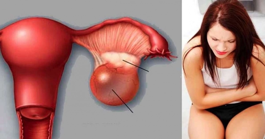 Подавленные эмоции и стресс: какова психосоматика кисты яичника - свежие новости на Toplenta по теме Для женщин  /  Соцпортал