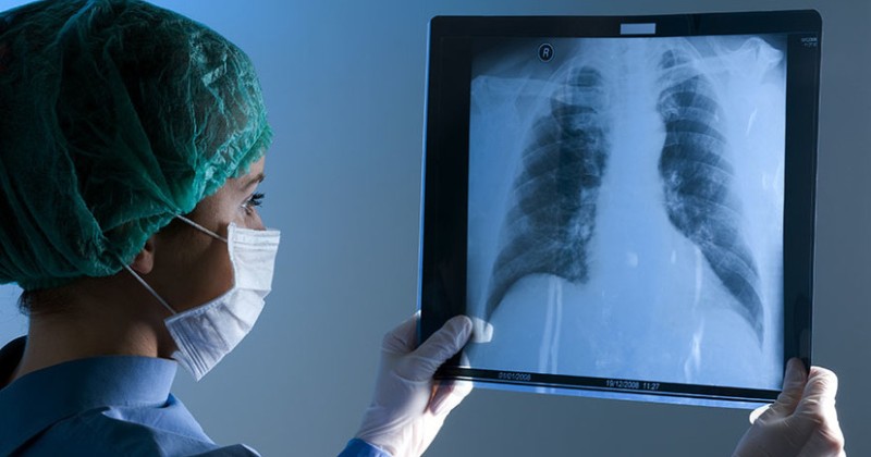 Как очистить легкие курильщика — лучшие способы, которые работают - свежие новости на Toplenta по теме ЗОЖ