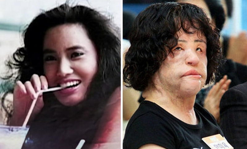 История Ханг Миоку — женщины, которая в погоне за красотой превратила себя в монстра - свежие новости на Toplenta по теме си