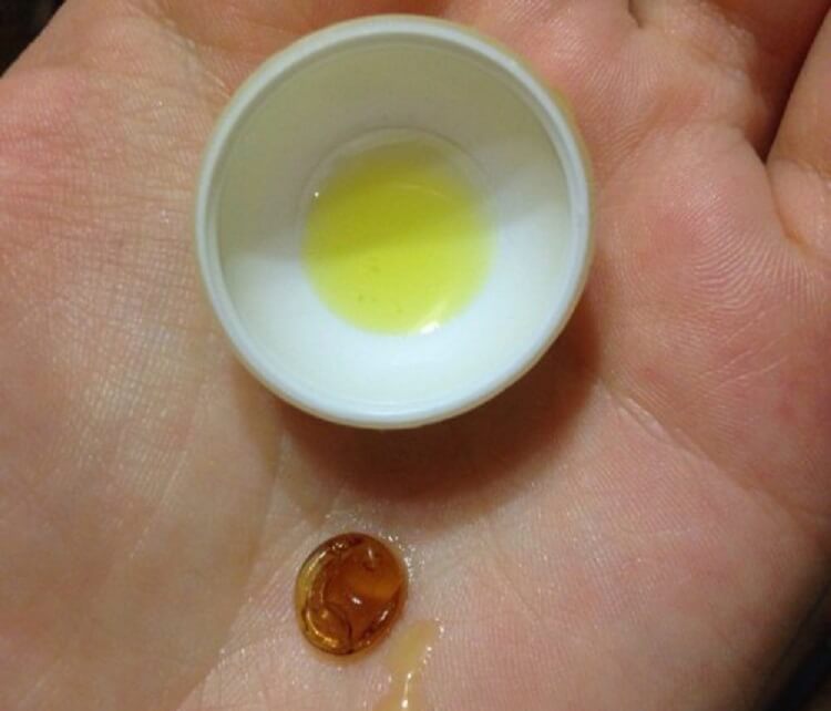 Лекарство «Аевит» творит чудеса! Действенное средство за копейки - свежие новости на Toplenta по теме Краснуху