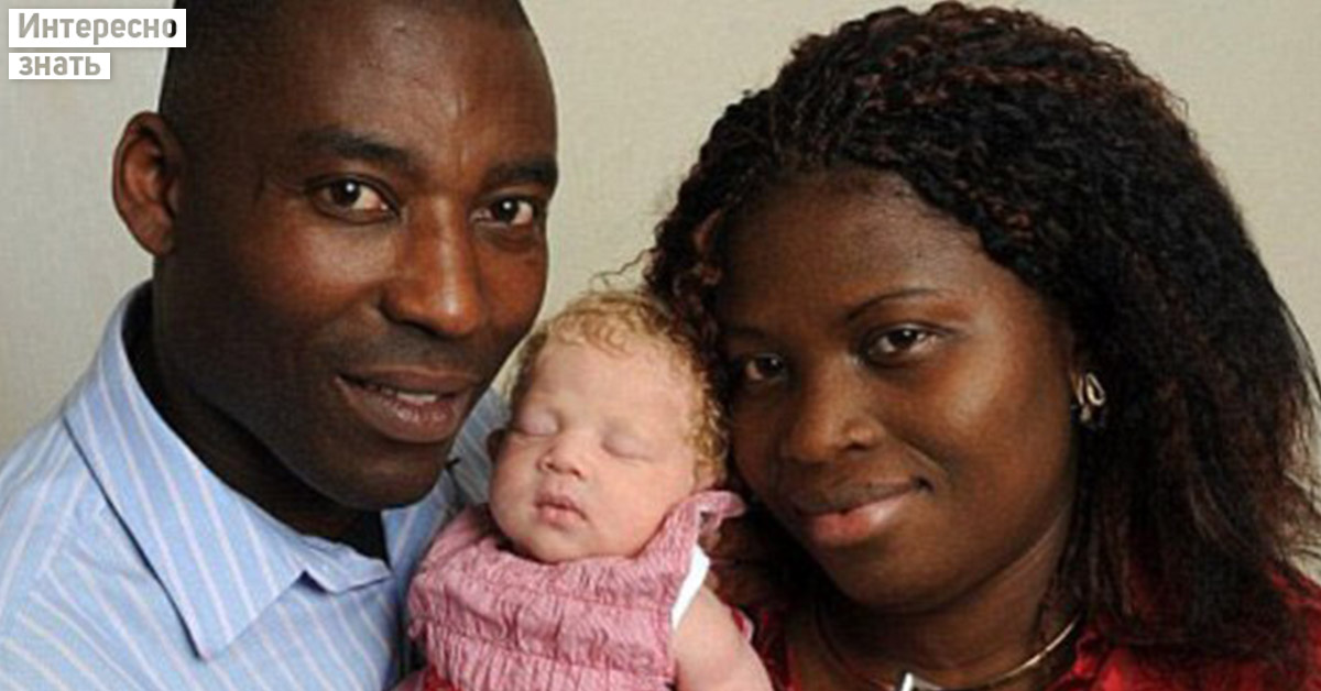 Как сейчас выглядит Белоснежка, которая 10 лет назад родилась в нигерийской семье - похожая новость на Toplenta