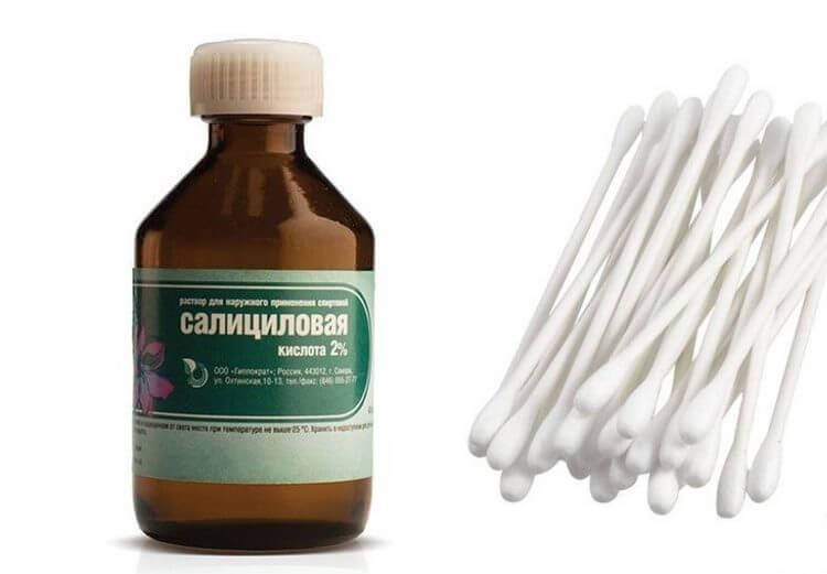 5 аптечных средств от акне, которые действительно помогают - свежие новости на Toplenta по теме Краснуху